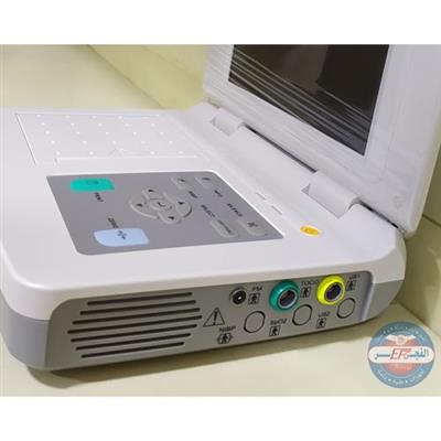 جهاز قياس نبض الجنين CTG Unicare fetal monitor