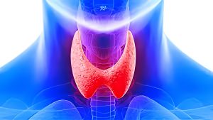 العلاج باليود المشع