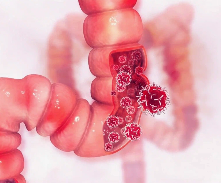 مناظير المعده