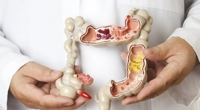 مناظير المعده