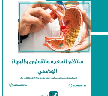 مناظير المعده