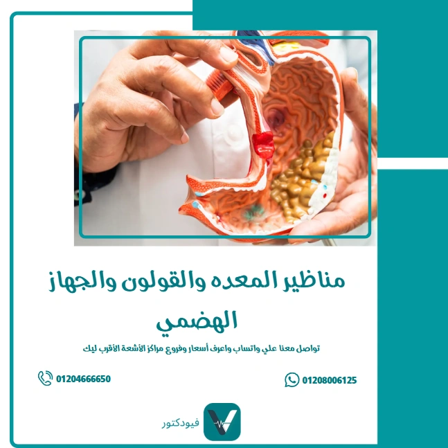 الرئيسية 21 مناظير المعده