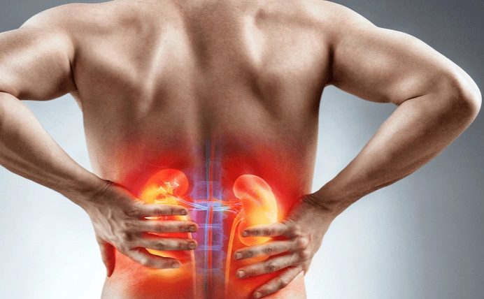 المسح الذري على الكلى 3 المسح الذري على الكلى