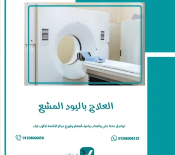 العلاج باليود المشع