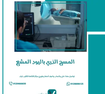 المسح الذري باليود المشع