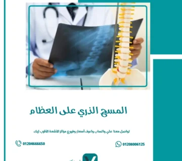 المسح الذري على العظام