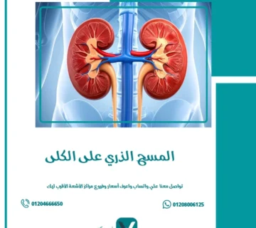 المسح الذري على الكلى