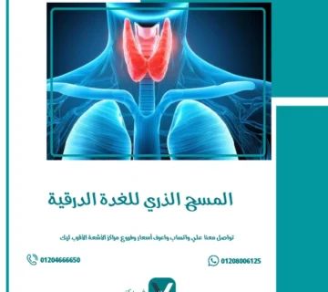 المسح الذري للغدة الدرقية