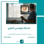 المنظار الهضمي العلوي