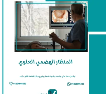 المنظار الهضمي العلوي