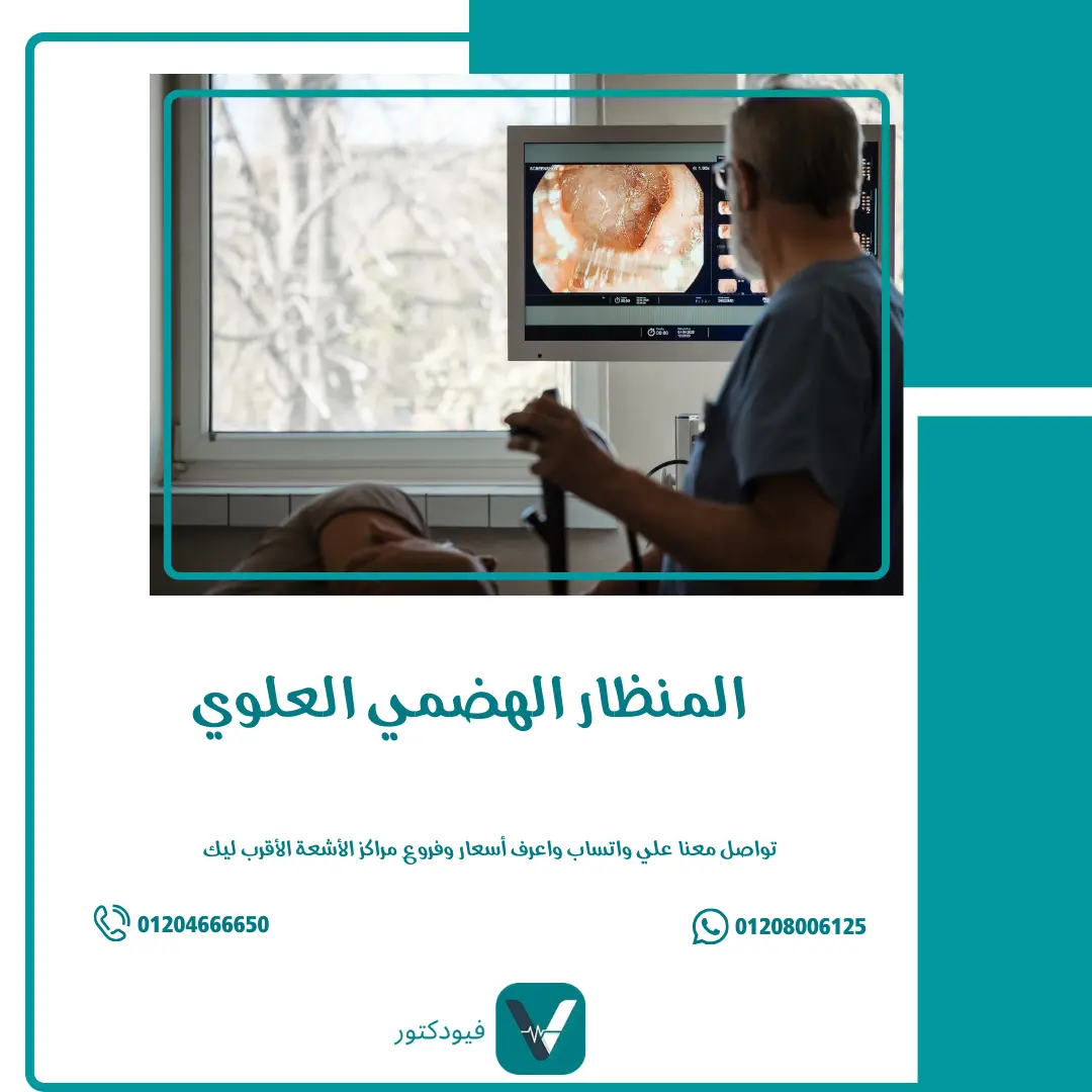 المنظار الهضمي العلوي