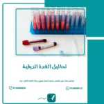 تحاليل الغدة الدرقية