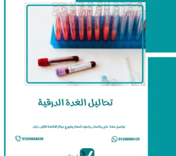 تحاليل الغدة الدرقية