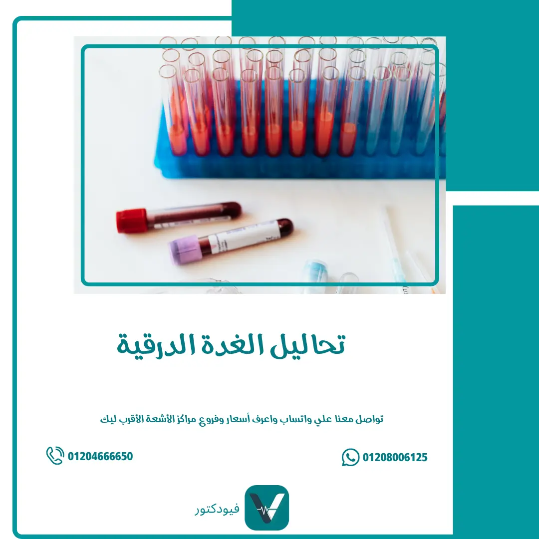 كل ما تحتاج معرفته عن تحاليل الغدة الدرقية: الأنواع والتشخيص والعلاج 1 تحاليل الغدة الدرقية