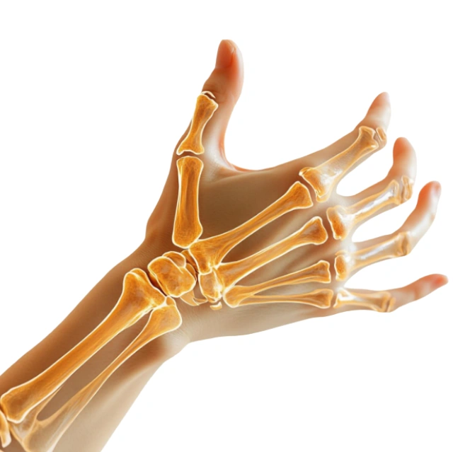 المسح الذري على العظام 4 المسح الذري على العظام