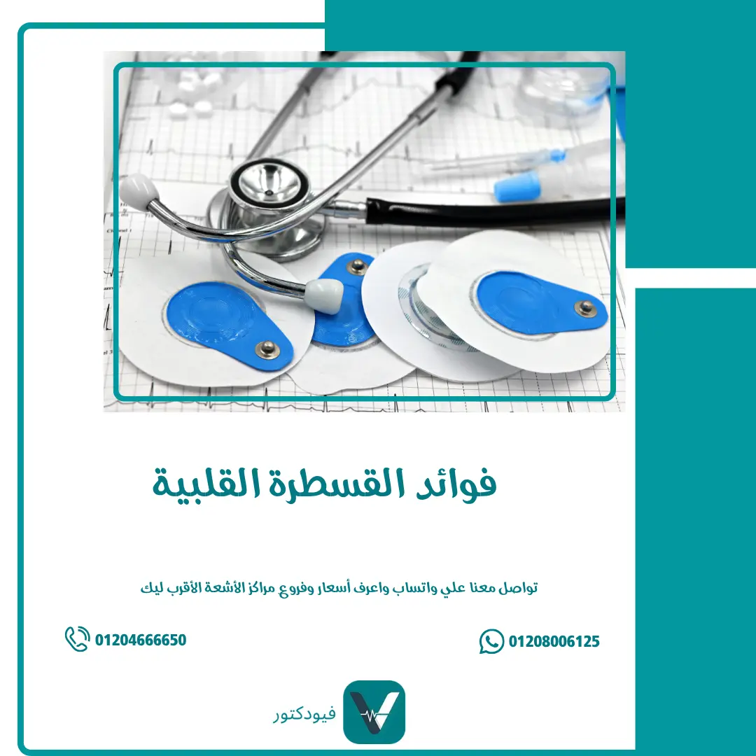 فوائد القسطرة القلبية