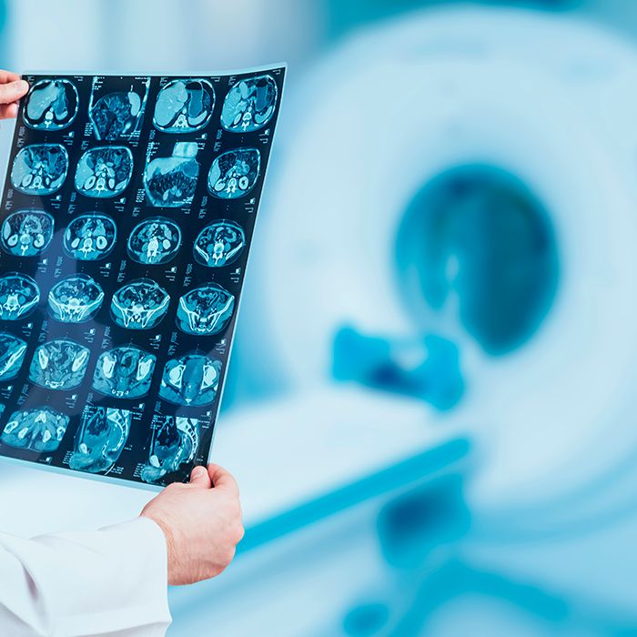 أسعار أشعة الرنين المغناطيسي: دليلك الشامل لفهم تكاليف هذا الفحص الطبي 2 أسعار أشعة الرنين المغناطيسي