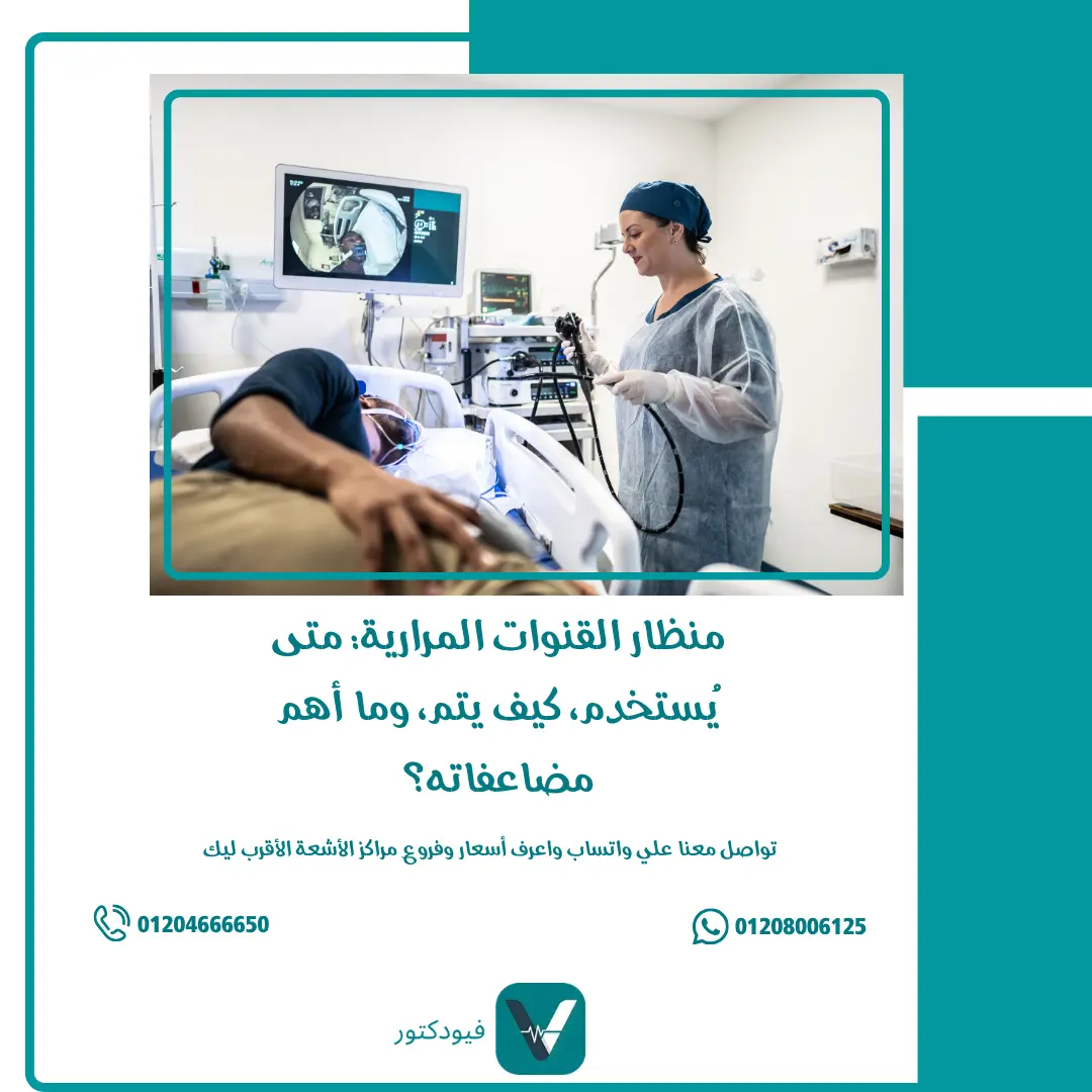 منظار القنوات المرارية