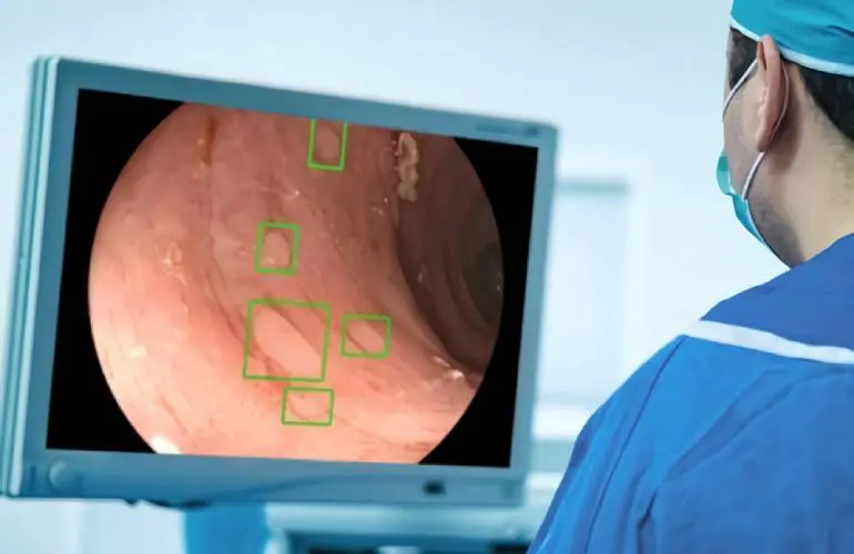 Medtronic GI Genius