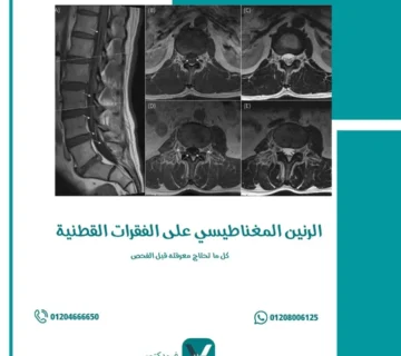 الرنين المغناطيسي على الفقرات القطنية