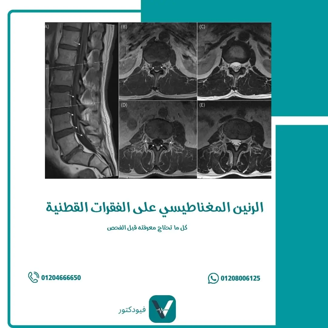الرئيسية 24 الرنين المغناطيسي على الفقرات القطنية