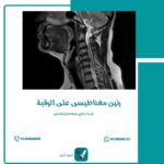 رنين مغناطيسي على الرقبة