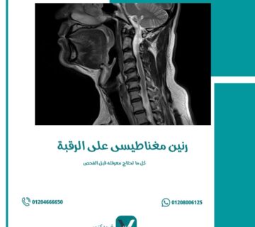 رنين مغناطيسي على الرقبة