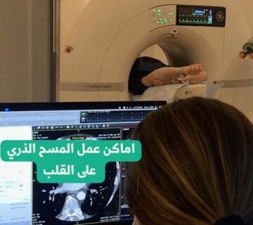 اماكن عمل المسح الذري على القلب
