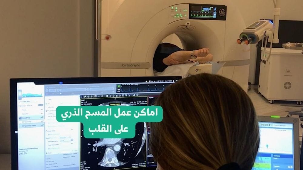 الرئيسية 24 اماكن عمل المسح الذري على القلب