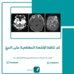 كم تكلفة الأشعة المقطعية على المخ