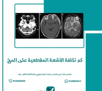 كم تكلفة الأشعة المقطعية على المخ