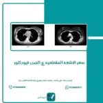 سعر الاشعه المقطعيه ع الصدر فيودكتور