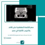 الأشعة المقطعية على الأنف