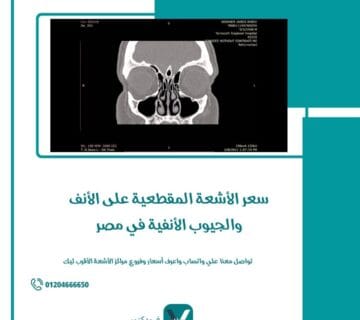 الأشعة المقطعية على الأنف