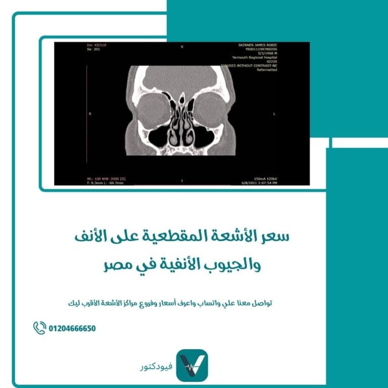 الأشعة المقطعية على الأنف