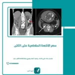 سعر الأشعة المقطعية على الكلى
