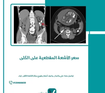 سعر الأشعة المقطعية على الكلى