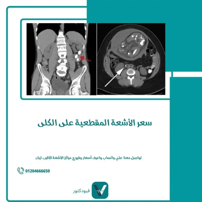 سعر الأشعة المقطعية على الكلى