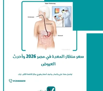 سعر منظار المعدة