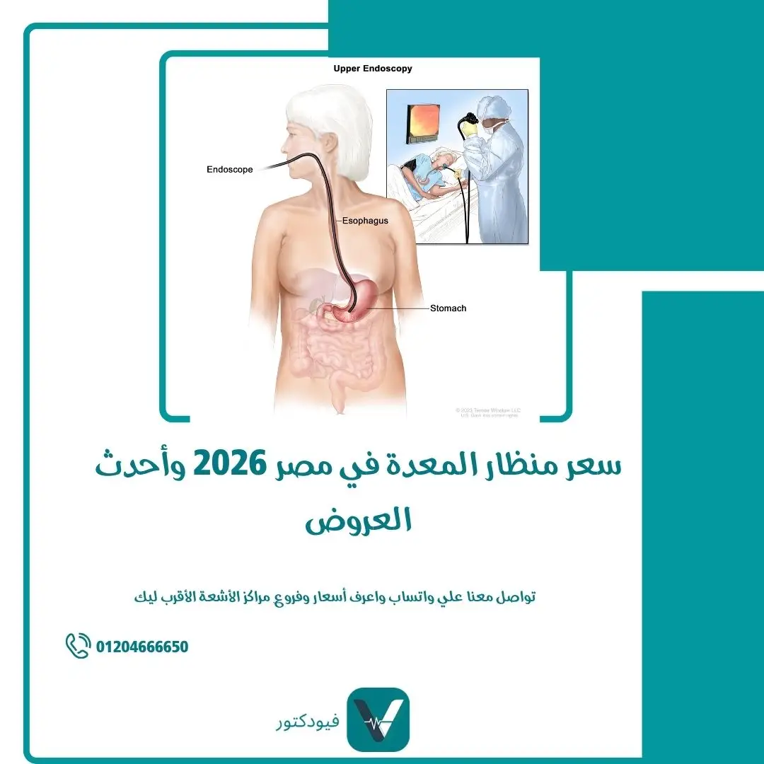 سعر منظار المعدة