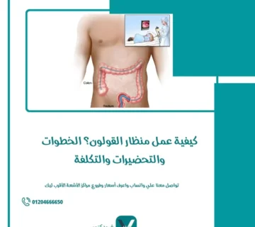 كيفية عمل منظار القولون