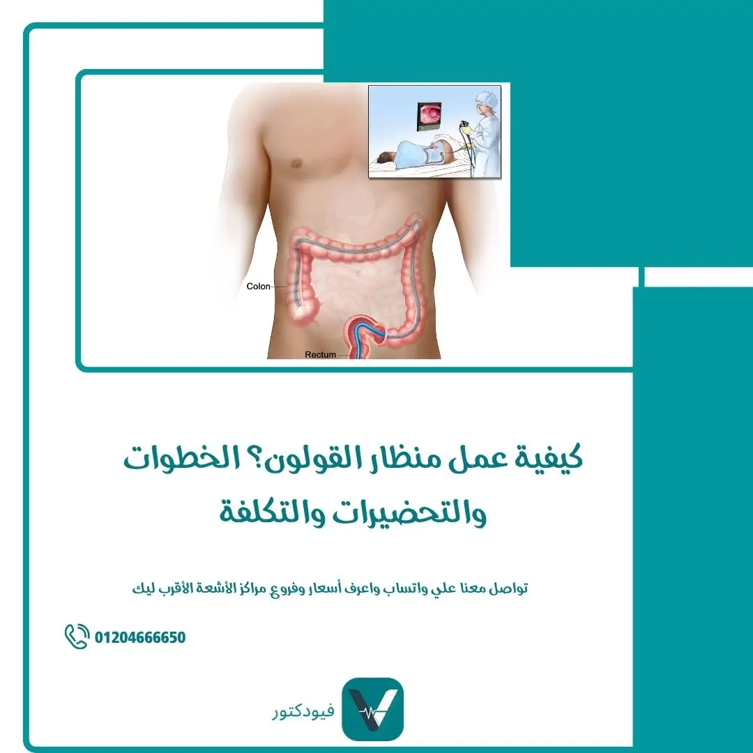 كيفية عمل منظار القولون