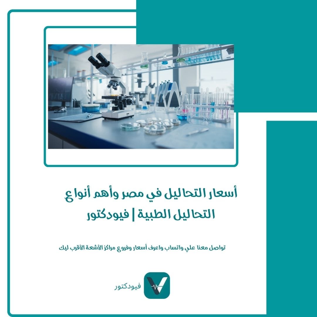 الرئيسية 29 أسعار التحاليل في مصر