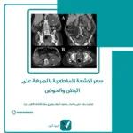 سعر الاشعة المقطعية بالصبغة على البطن والحوض