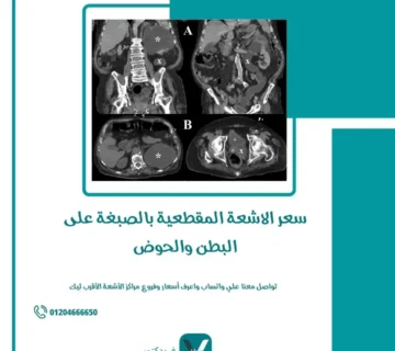 سعر الاشعة المقطعية بالصبغة على البطن والحوض