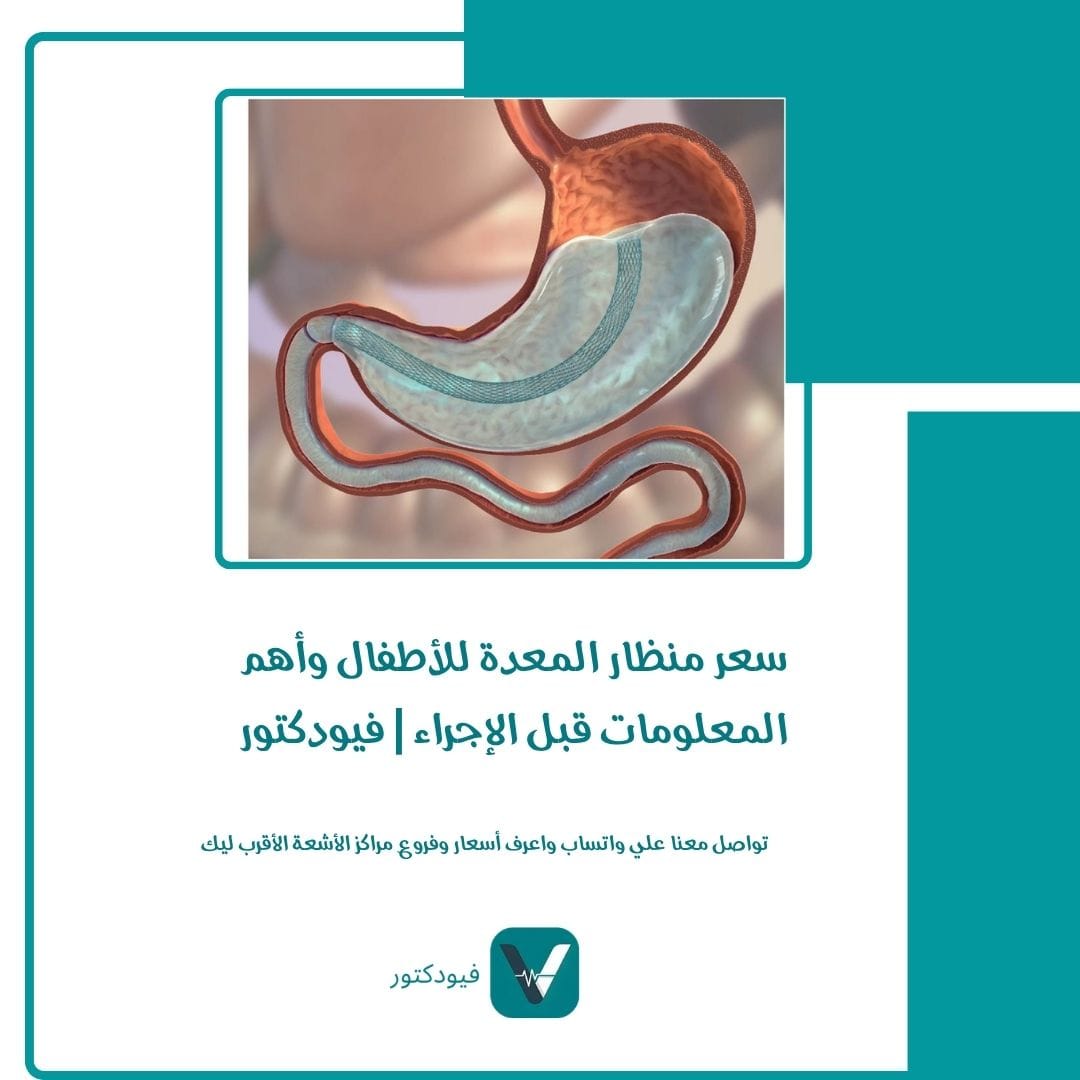 الرئيسية 30 سعر منظار المعدة للأطفال
