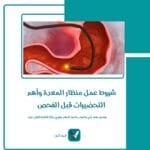 شروط عمل منظار المعدة