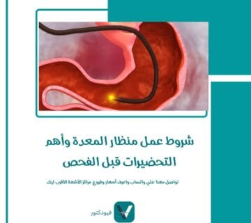 شروط عمل منظار المعدة