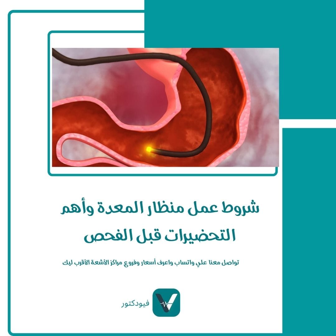 الرئيسية 31 شروط عمل منظار المعدة