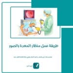 طريقة عمل منظار المعدة